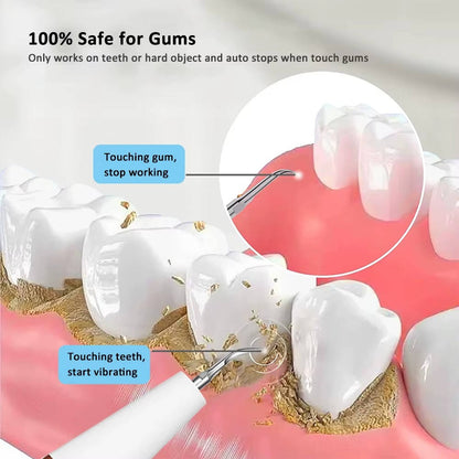 Electric Dental Teeth Calculus and Tartar Remover Kit, 5 Adjustable Modes with Led Light