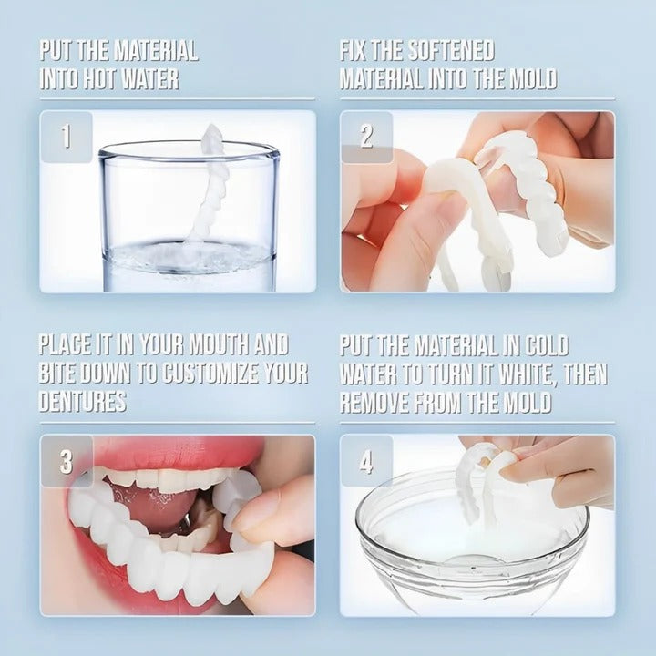 Removable Smile Veneers for Upper and Lower Teeth