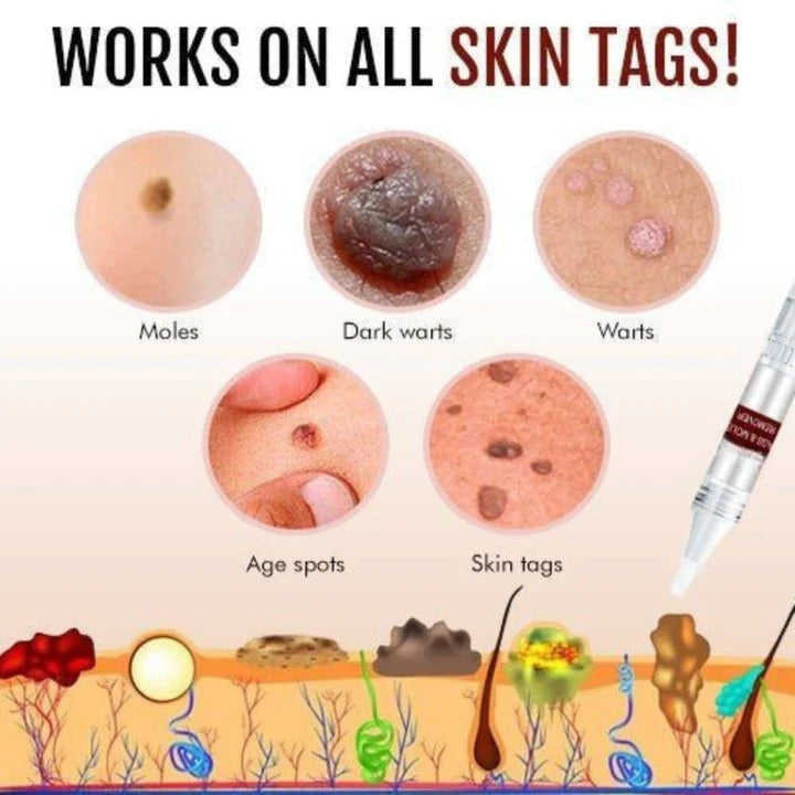 Skin Tag and Mole Appearance Cosmetic Oil
